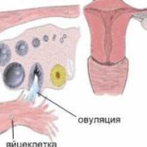 Informace o tom, jak najít gestační gynekologové