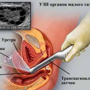 Intimní otázky: Je možné provést ultrazvukové vyšetření při menstruaci? 2