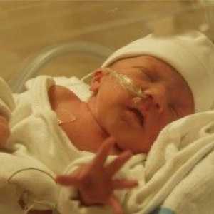 Cerebrální ischemie u novorozenců