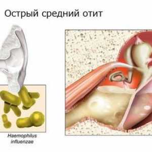 Účinnost léčby zánětu středního ucha s antibiotiky