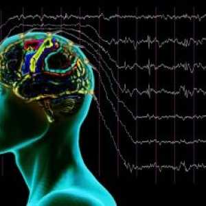 EEG u epilepsie - zejména studium a montáž diagnózy