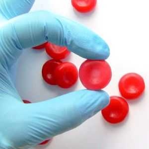 Červené krvinky: funkce, počet pravidel v krvi, příčiny odchylek