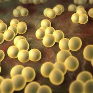 Jak se vypořádat s Staphylococcus aureus ve střevech?