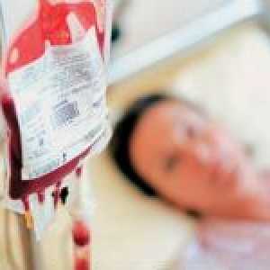 Jak to udělat transfuzi krve