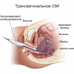 Jak se vaginální ultrazvuk: přípravu, řízení a dekódování