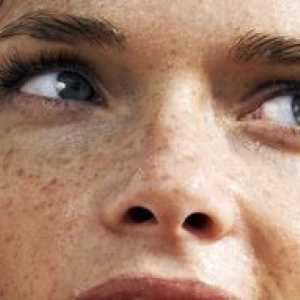 Jak se zbavit pigmentace na obličeji