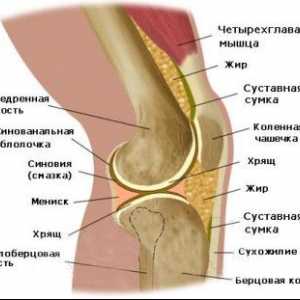 Jaké jsou příznaky artritidy kolene