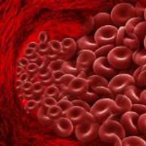 Jak snížit hladinu hemoglobinu v krvi: strava, léky a tradiční recepty