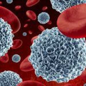Jak snížit počet bílých krvinek v krvi