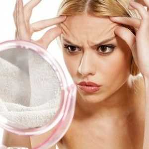 Jak odstranit jizvy na obličeji po akné