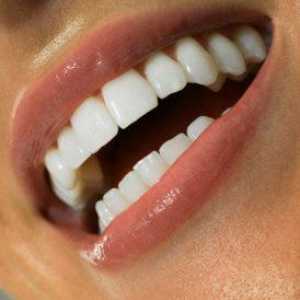 Jak odstranit zubní kámen doma