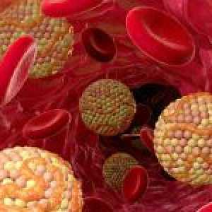 Jaká je míra cholesterolu v krvi, a nebezpečí překročení jejího