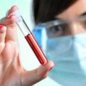 Jaká je míra bilirubinu v krvi dětí, žen a mužů? Biochemická analýza krve.