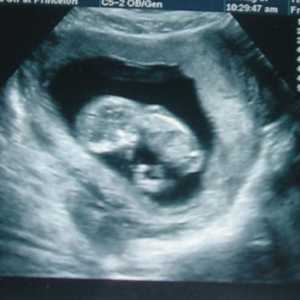 Kalendářní životnost dítě od devátého týdne těhotenství