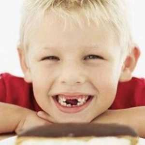 Zubní kaz a jeho příčiny