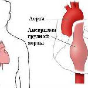 Klinické příznaky aorty