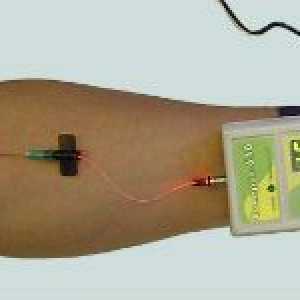 Laserové ozařování krve