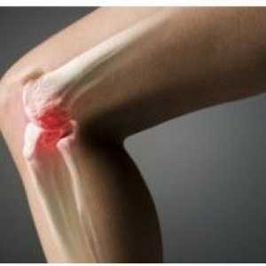 Léčba kolenního kloubu po poranění lidových prostředků