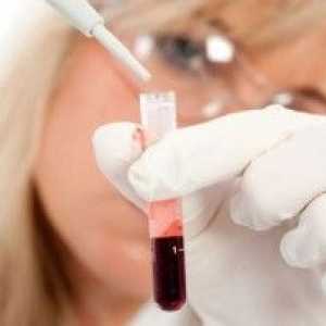 Leukocytů v krvi během těhotenství