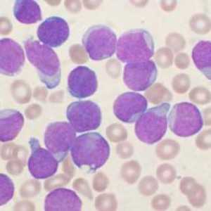 Lymfocytů v lidské krvi