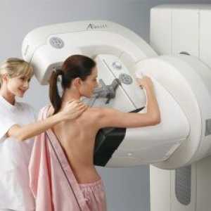 Mamografie: indikace, kontraindikace, a na který den dělat mamogram