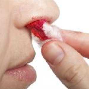 Mezi hlavní příčiny krvácení z nosu