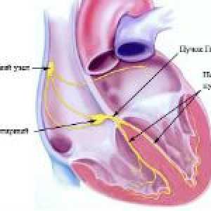 Porušení arytmie a vedení v srdci