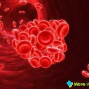 Sodíku v krvi: standard, hyponatremie, gipernatiemiya