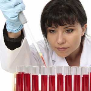 Norma hemoglobinu u žen