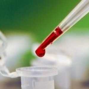 Celkový obsah bílkovin v krvi