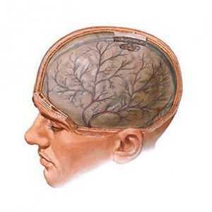 Mozkový edém: příčiny a formy, příznaky, léčba, komplikace a prognóza