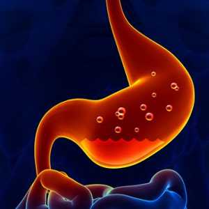 Vypálit žaludku - příčiny, příznaky a léčba