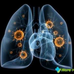 Příznaky pneumonie bez horečky: jak rozpoznat nemoc včas