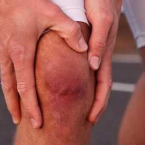 Proč je oteklé a bolavé koleno