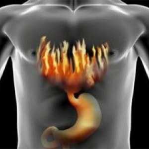 Snížená žaludeční kyselost: příznaky, léčba lidových prostředků