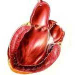 Hlavními příznaky infarktu myokardu