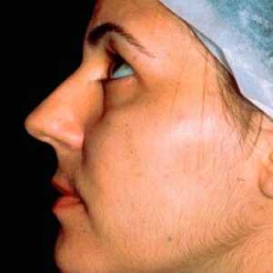 Výhody epilace s obličeje odstraňování chloupků