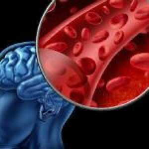 Léky, které zvyšují průtok krve do mozku