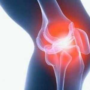 Příčiny a léčba bolesti kloubů v menopauze