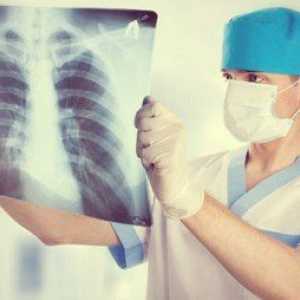 Příčiny a léčba intersticiální plicní edém