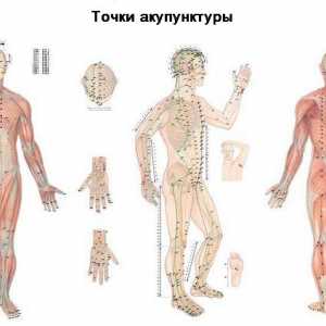 Použití akupunktury