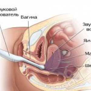 Aplikace Ultrazvuk v gynekologii