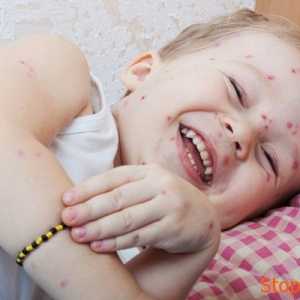 Pustulózní vyrážky na kůži dítěte