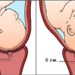 Děložního čípku před porodu