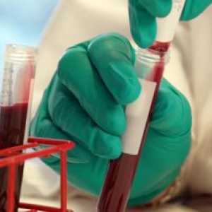 Dekódování hlavních ukazatelů člověka krevní chemii