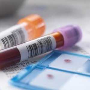 Rozluštění biochemickou analýzu krevních parametrů u dětí