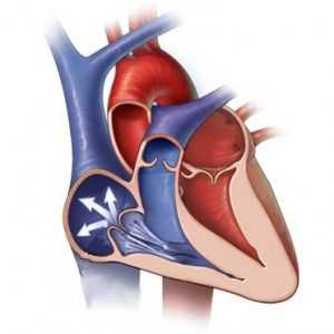 Srdeční chlopně regurgitace: symptomy, rozsah, diagnostika, léčba