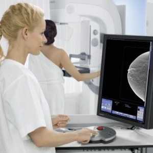 X-ray screening prsu: mamografie