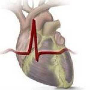 Revmatické srdeční