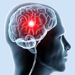Posunovací cév hlavy: odstraňují porušení průtoku krve mozkem?